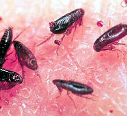 Fleas
